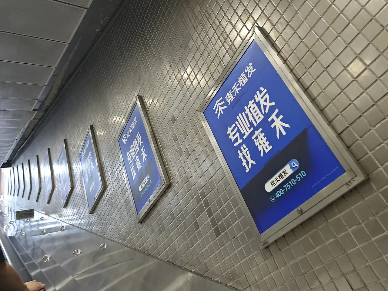 牛马该植发了!